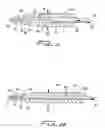 Fig. 07 - Dialysis catheter