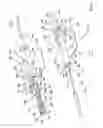 Fig. 02 - Safety catheter