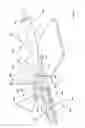 Fig. 03 - Safety catheter