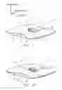 Fig. 02 - Anchoring system for a medical article