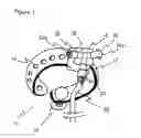 Fig. 02 - Multiport infusion device