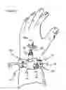 Fig. 03 - Multiport infusion device