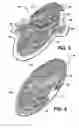 Fig. 04 - Absorbent article with time-delayed absorbent binder composition
