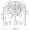 Fig. 09 - Absorbent garment having outer shell and adjustable absorbent assembly therein