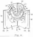 Fig. 10 - Absorbent garment having outer shell and adjustable absorbent assembly therein