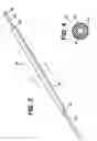 Fig. 03 - Method for implanting flexible injection port