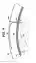 Fig. 08 - Method for implanting flexible injection port