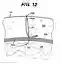 Fig. 09 - Method for implanting flexible injection port