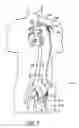 Fig. 04 - Cannulae for selectively enhancing blood flow
