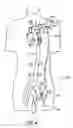 Fig. 05 - Cannulae for selectively enhancing blood flow