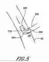 Fig. 06 - Cannulae for selectively enhancing blood flow