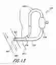 Fig. 14 - Cannulae for selectively enhancing blood flow