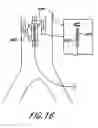 Fig. 17 - Cannulae for selectively enhancing blood flow