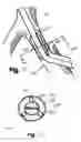 Fig. 23 - Cannulae for selectively enhancing blood flow