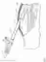 Fig. 08 - Method and device for minimally invasive implantation of biomaterial