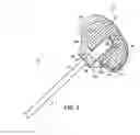 Fig. 03 - Systems, methods and devices relating to delivery of medical implants