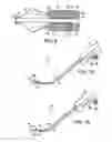 Fig. 07 - Systems, methods and devices relating to delivery of medical implants