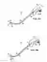 Fig. 08 - Systems, methods and devices relating to delivery of medical implants