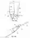 Fig. 31 - Systems, methods and devices relating to delivery of medical implants