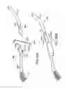 Fig. 51 - Systems, methods and devices relating to delivery of medical implants