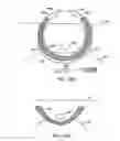 Fig. 72 - Systems, methods and devices relating to delivery of medical implants