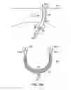 Fig. 77 - Systems, methods and devices relating to delivery of medical implants
