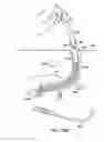 Fig. 78 - Systems, methods and devices relating to delivery of medical implants