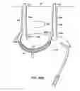 Fig. 82 - Systems, methods and devices relating to delivery of medical implants