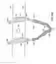 Fig. 88 - Systems, methods and devices relating to delivery of medical implants