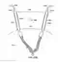 Fig. 93 - Systems, methods and devices relating to delivery of medical implants