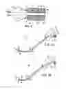 Fig. 07 - Systems, methods and devices relating to delivery of medical implants