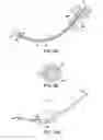Fig. 09 - Systems, methods and devices relating to delivery of medical implants