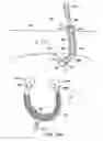 Fig. 69 - Systems, methods and devices relating to delivery of medical implants