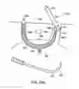 Fig. 80 - Systems, methods and devices relating to delivery of medical implants