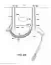 Fig. 82 - Systems, methods and devices relating to delivery of medical implants
