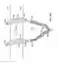 Fig. 88 - Systems, methods and devices relating to delivery of medical implants