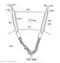 Fig. 93 - Systems, methods and devices relating to delivery of medical implants