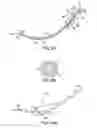 Fig. 09 - Systems, methods and devices relating to delivery of medical implants