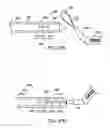 Fig. 63 - Systems, methods and devices relating to delivery of medical implants