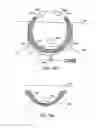 Fig. 72 - Systems, methods and devices relating to delivery of medical implants