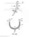 Fig. 77 - Systems, methods and devices relating to delivery of medical implants