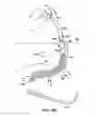Fig. 78 - Systems, methods and devices relating to delivery of medical implants