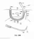 Fig. 80 - Systems, methods and devices relating to delivery of medical implants