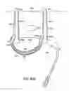 Fig. 82 - Systems, methods and devices relating to delivery of medical implants