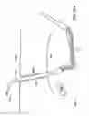 Fig. 92 - Systems, methods and devices relating to delivery of medical implants