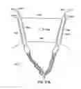 Fig. 93 - Systems, methods and devices relating to delivery of medical implants