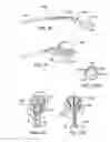 Fig. 07 - Energy based devices and methods for treatment of anatomic tissue defects