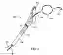Fig. 09 - Energy based devices and methods for treatment of anatomic tissue defects