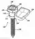 Fig. 01 - Polyaxial adjustment of facet joint prostheses