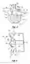 Fig. 03 - Polyaxial adjustment of facet joint prostheses